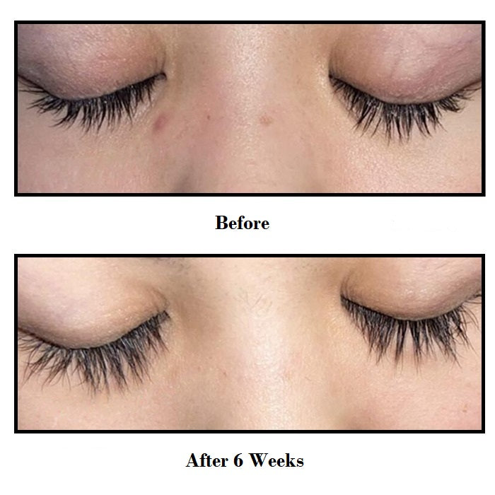 Cicia Eyelash Growth Serum Before and After Customer 1